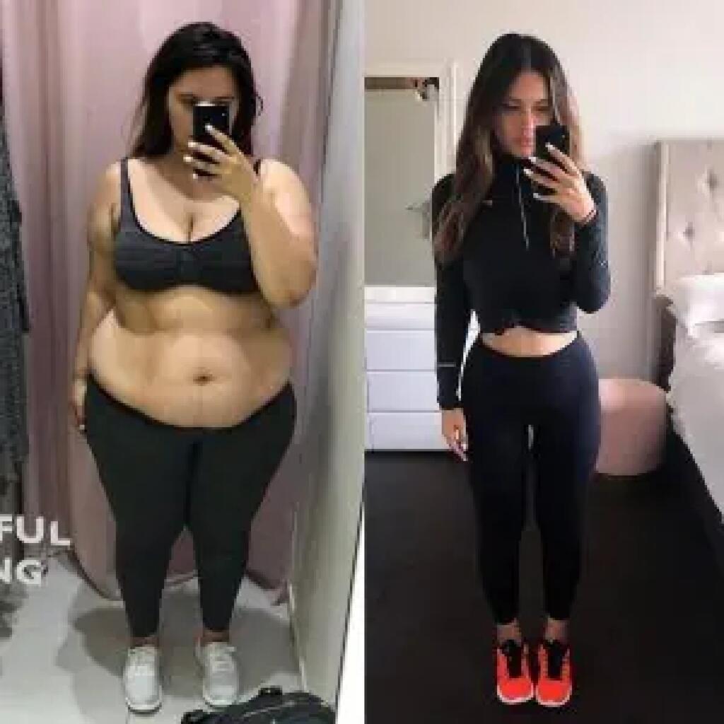 Semaglutide Ozempic weight loss injections work