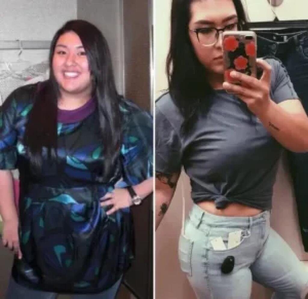 weight loss using Tirzepatide Weight Loss Consultation