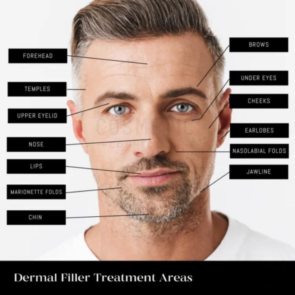 Dermal Fillers gives smoother skin, fuller lips, natural looking results