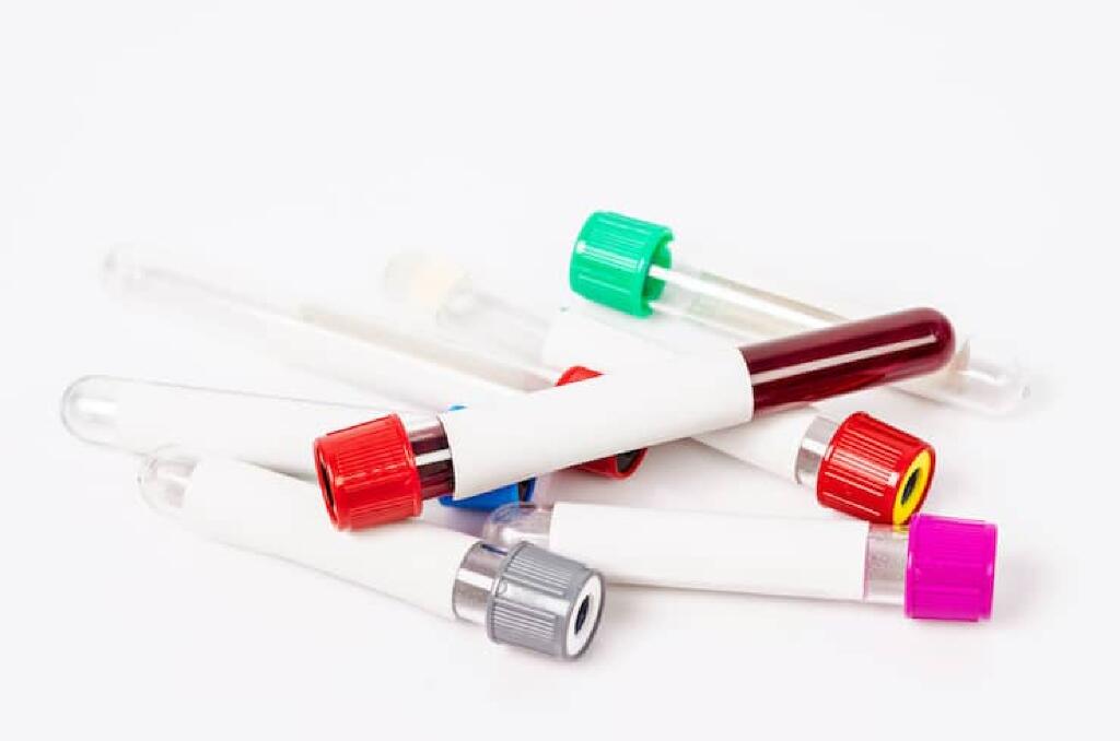 Self Pay Blood Labs by Brandon Medical Center