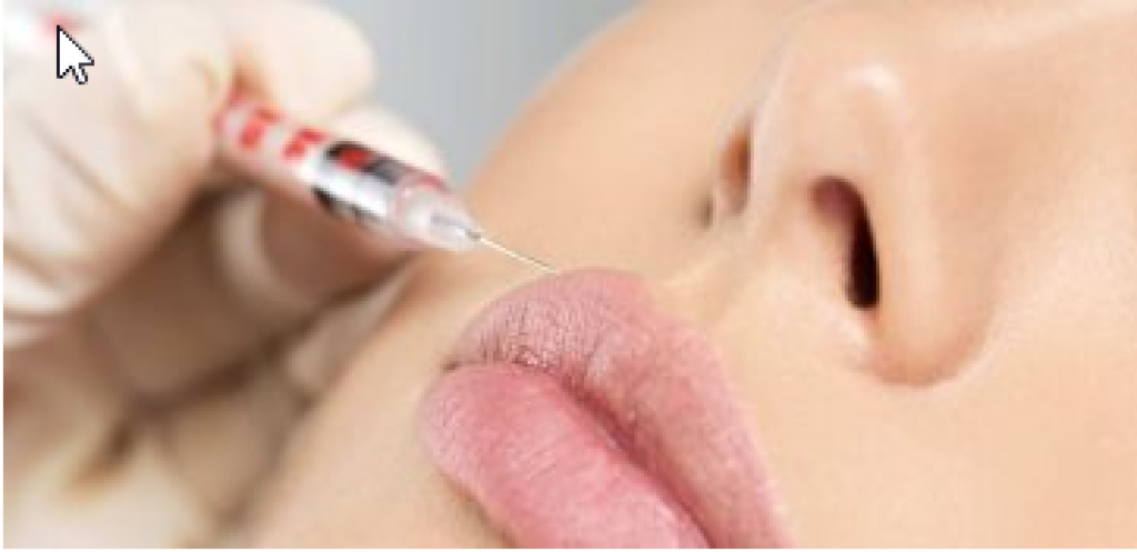 Botox and Dermal Fillers, watch winkles disappear