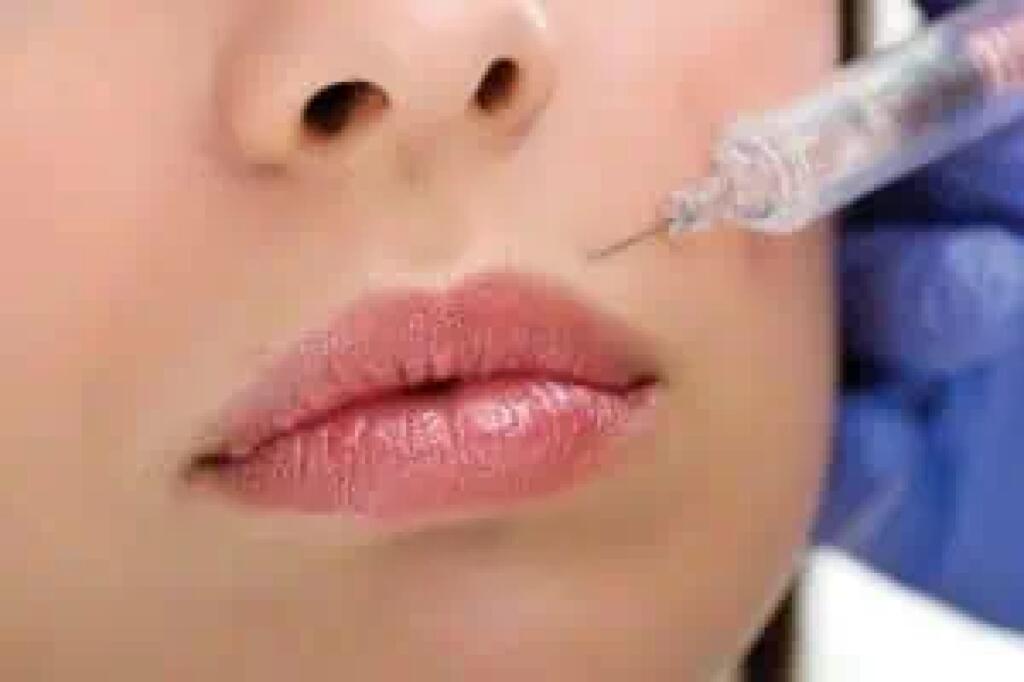 Botox injections to minimize wrinkles, forehead, crows feets